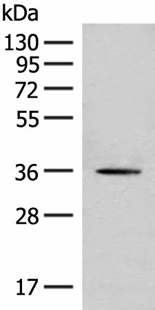 Western blot analysis of Hela cell lysate using MLST8 Polyclonal Antibody at dilution of 1:500