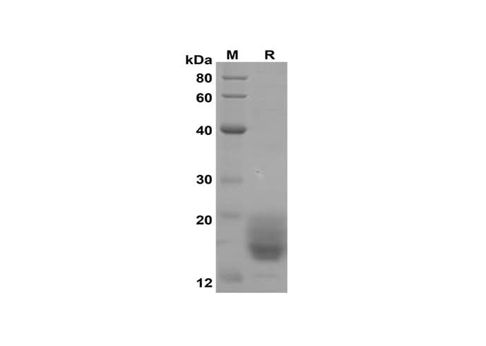 SDS-PAGE analysis of Human IL-5 proteins, 2 μg/lane of Recombinant Human IL-5 proteins was resolved with SDS-PAGE under reducing conditions,showing bands at 15-20 kDa.