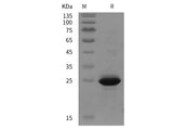 SDS-PAGE analysis of Human CD146/MCAM proteins, 2 μg/lane of Recombinant Human CD146/MCAM proteins was resolved with SDS-PAGE under reducing conditions, showing bands at 25 kDa.