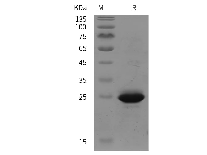 SDS-PAGE analysis of Human CD146/MCAM proteins, 2 μg/lane of Recombinant Human CD146/MCAM proteins was resolved with SDS-PAGE under reducing conditions, showing bands at 25 kDa.