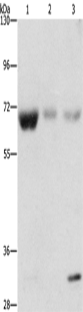 Anti-Human/Mouse/Rat NAE1 Antibody - ABMIUM