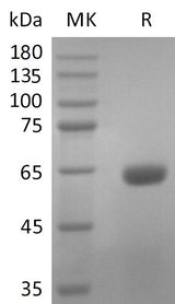 Recombinant SARS-CoV-2 S Protein RBD (C-mFc) V2 - ABMIUM