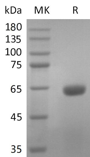Recombinant SARS-CoV-2 S Protein RBD (C-mFc) V2 - ABMIUM
