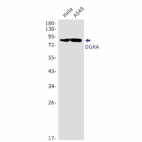 Western blot detection of DGKA in Hela,A549 cell lysates using DGKA Rabbit mAb(1:1000 diluted).Predicted band size:83kDa.Observed band size:83kDa.