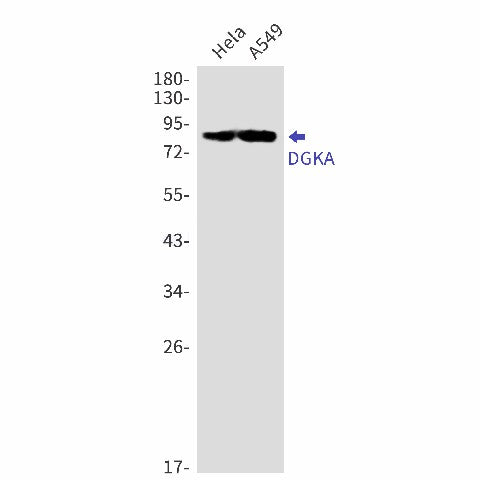 Western blot detection of DGKA in Hela,A549 cell lysates using DGKA Rabbit mAb(1:1000 diluted).Predicted band size:83kDa.Observed band size:83kDa.