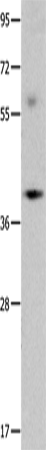 Anti-Human/Mouse/Rat OPCML Antibody - ABMIUM