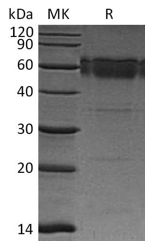 Recombinant Mouse TRAIL R2/TNFRSF10B Protein (Fc Tag) - ABMIUM