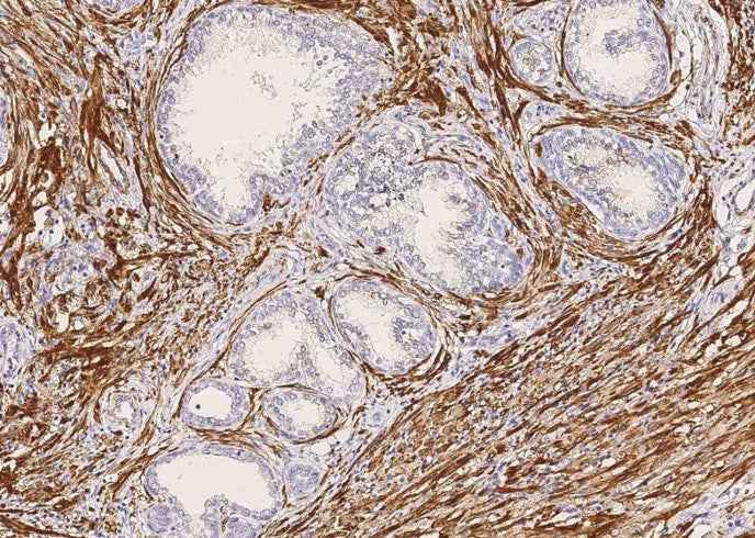Anti-Human MYH11 Antibody [B220] - ABMIUM