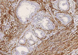 Anti-Human MYH11 Antibody [B220]