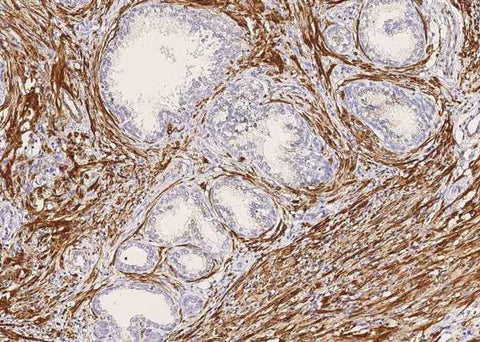 Anti-Human MYH11 Antibody [B220] - ABMIUM