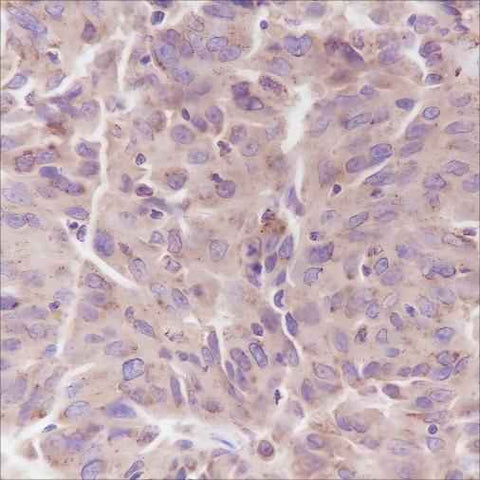 Anti-Human/Mouse PI3 Kinase p85 alpha Antibody [A332] - ABMIUM