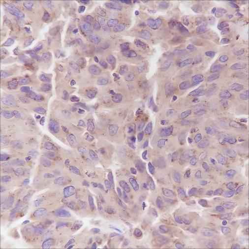 Anti-Human/Mouse PI3 Kinase p85 alpha Antibody [A332] - ABMIUM