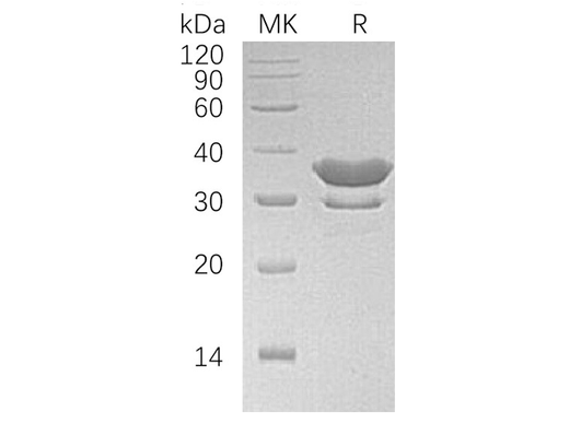 Recombinant Human SULT2A1 Protein (His Tag) - ABMIUM