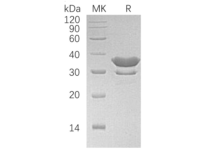 Recombinant Human SULT2A1 Protein (His Tag) - ABMIUM