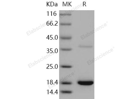 Recombinant Human Transthyretin/TTR Protein (His Tag) - ABMIUM