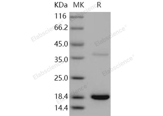 Recombinant Human Transthyretin/TTR Protein (His Tag) - ABMIUM