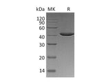 Recombinant Human SERPINB9/PI-9 Protein (Human Cells, His Tag) - ABMIUM