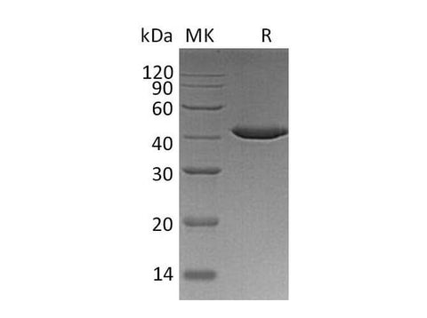 Recombinant Human SERPINB9/PI-9 Protein (Human Cells, His Tag) - ABMIUM