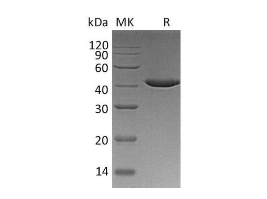 Recombinant Human SERPINB9/PI-9 Protein (Human Cells, His Tag) - ABMIUM