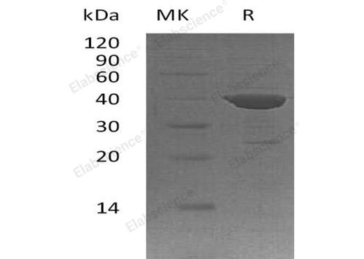 Recombinant Human ADPRH/ARH1 Protein (His Tag) - ABMIUM