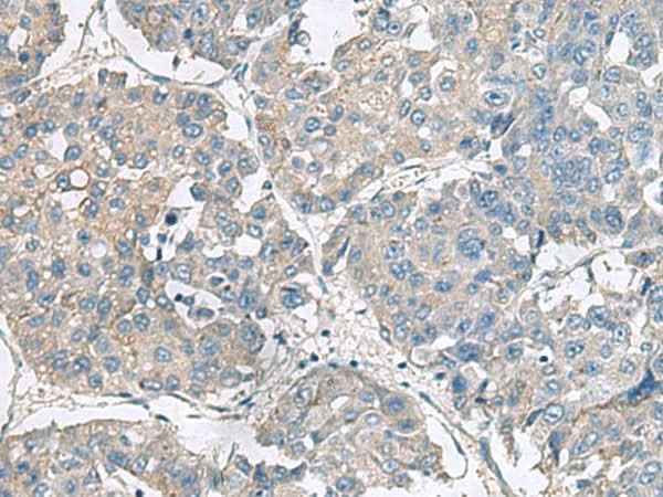 Anti-Human NPHP1 Antibody