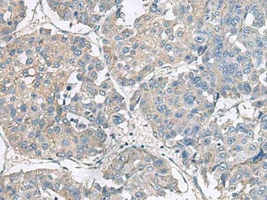 Anti-Human NPHP1 Antibody