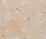 Anti-Human MMP25 Antibody - ABMIUM