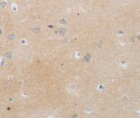 Anti-Human MMP25 Antibody
