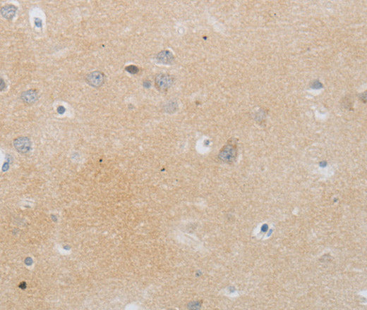 Anti-Human MMP25 Antibody - ABMIUM