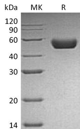 Recombinant Mouse REN1/Renin-1 Protein (His Tag) - ABMIUM