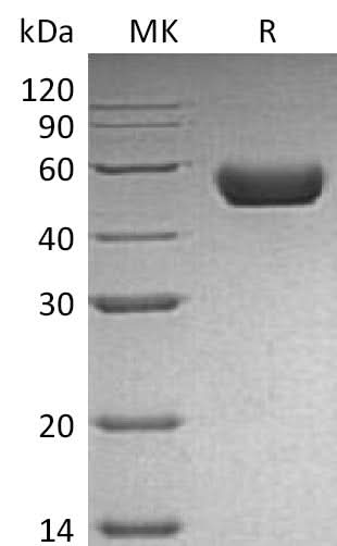 Recombinant Mouse REN1/Renin-1 Protein (His Tag) - ABMIUM