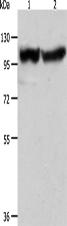 Anti-Human/Mouse ACTN3 Antibody - ABMIUM