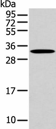 Western blot analysis of Mouse muscle tissue using NANOS1 Polyclonal Antibody at dilution of 1:500