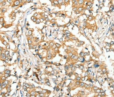 Anti-Human/Mouse SIRT4 Antibody - ABMIUM