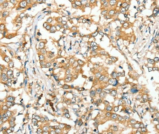 Anti-Human/Mouse SIRT4 Antibody - ABMIUM