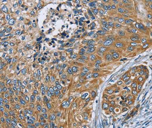 Anti-Human/Mouse ZMYND11 Antibody