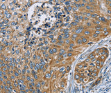 Anti-Human/Mouse ZMYND11 Antibody - ABMIUM