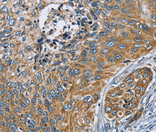 Anti-Human/Mouse ZMYND11 Antibody - ABMIUM