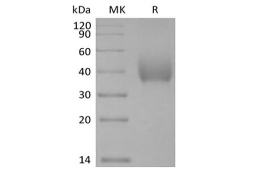 Recombinant Human SLAM Family Member 7/SLAMF7/CD319/CRACC (C-6His-Avi) Biotinylated - ABMIUM