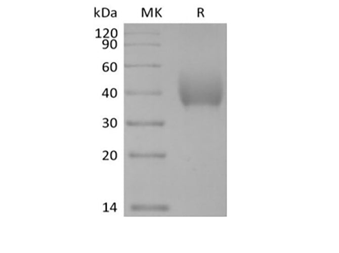 Recombinant Human SLAM Family Member 7/SLAMF7/CD319/CRACC (C-6His-Avi) Biotinylated - ABMIUM