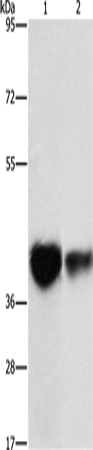 Anti-Human/Mouse/Rat IDH3G Antibody - ABMIUM