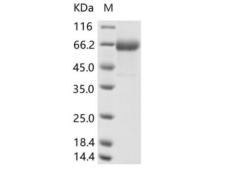 Recombinant Human parainfluenza virus 4b (HPIV-4b) Hemagglutinin-neuraminidase(aa 48-579, His Tag) - ABMIUM