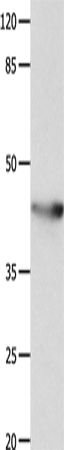 Anti-Human/Mouse/Rat KCNA5 Antibody - ABMIUM