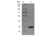 SDS-PAGE analysis of Rat MMP-2/CLG4A proteins, 2 μg/lane of Recombinant Rat MMP-2/CLG4A proteins was resolved with SDS-PAGE under reducing conditions, showing bands at 35 kDa.