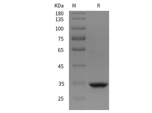 SDS-PAGE analysis of Rat MMP-2/CLG4A proteins, 2 μg/lane of Recombinant Rat MMP-2/CLG4A proteins was resolved with SDS-PAGE under reducing conditions, showing bands at 35 kDa.