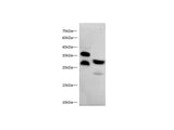 Anti-Human/Mouse/Rat MBL2/MBP-C Antibody - ABMIUM