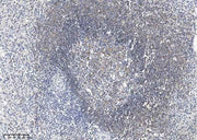 Anti-Human CD19 Antibody [A962] - ABMIUM