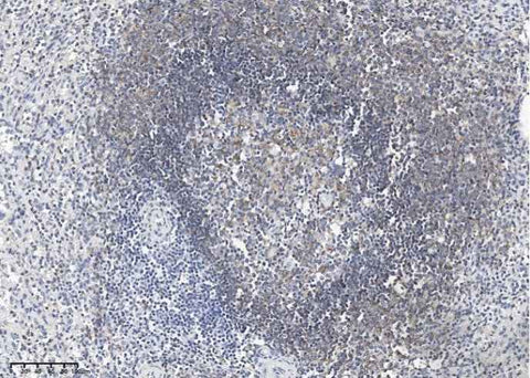 Anti-Human CD19 Antibody [A962] - ABMIUM