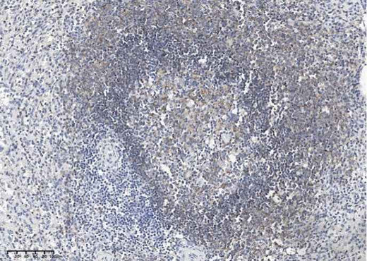 Anti-Human CD19 Antibody [A962] - ABMIUM