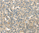 Anti-Human/Mouse/Rat RASA2 Antibody - ABMIUM